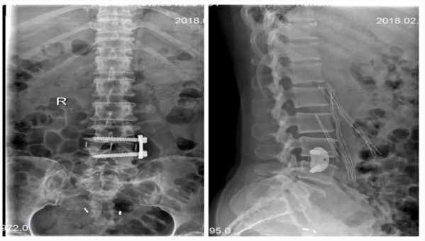 1537955899938950.png image.png