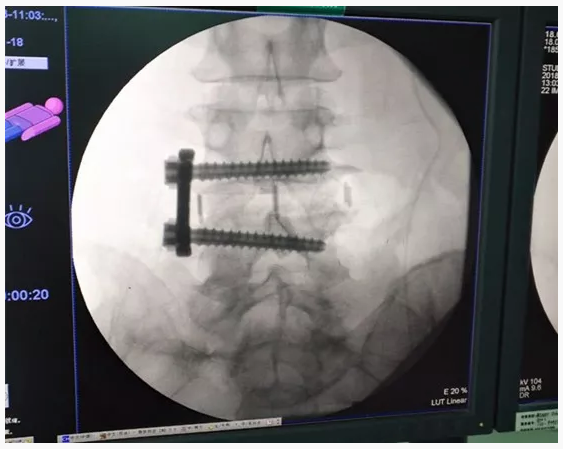 1537955951171149.png 1537955951171149.png