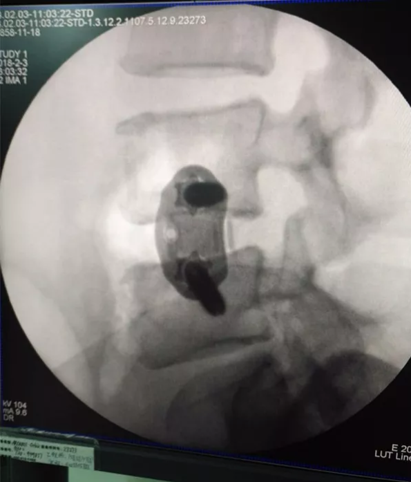 1537956008557431.png 1537956008557431.png