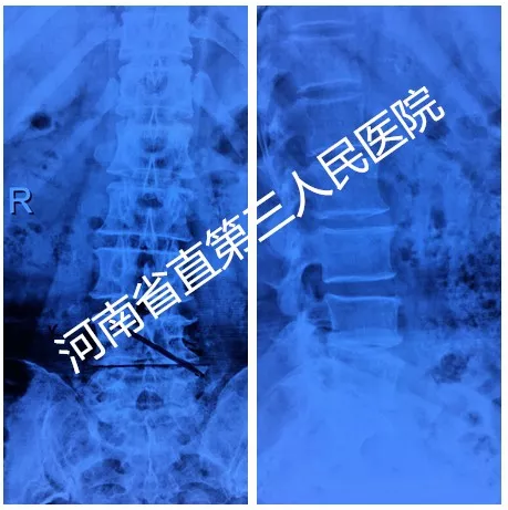 1537959772124450.png image.png