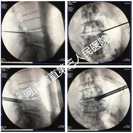 1537959902879864.png image.png