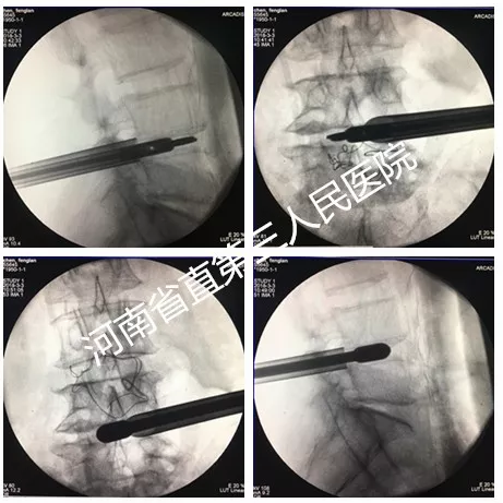 1537959971225082.png image.png