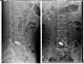 1545703360538052.png 傲游截图20181225095805.png