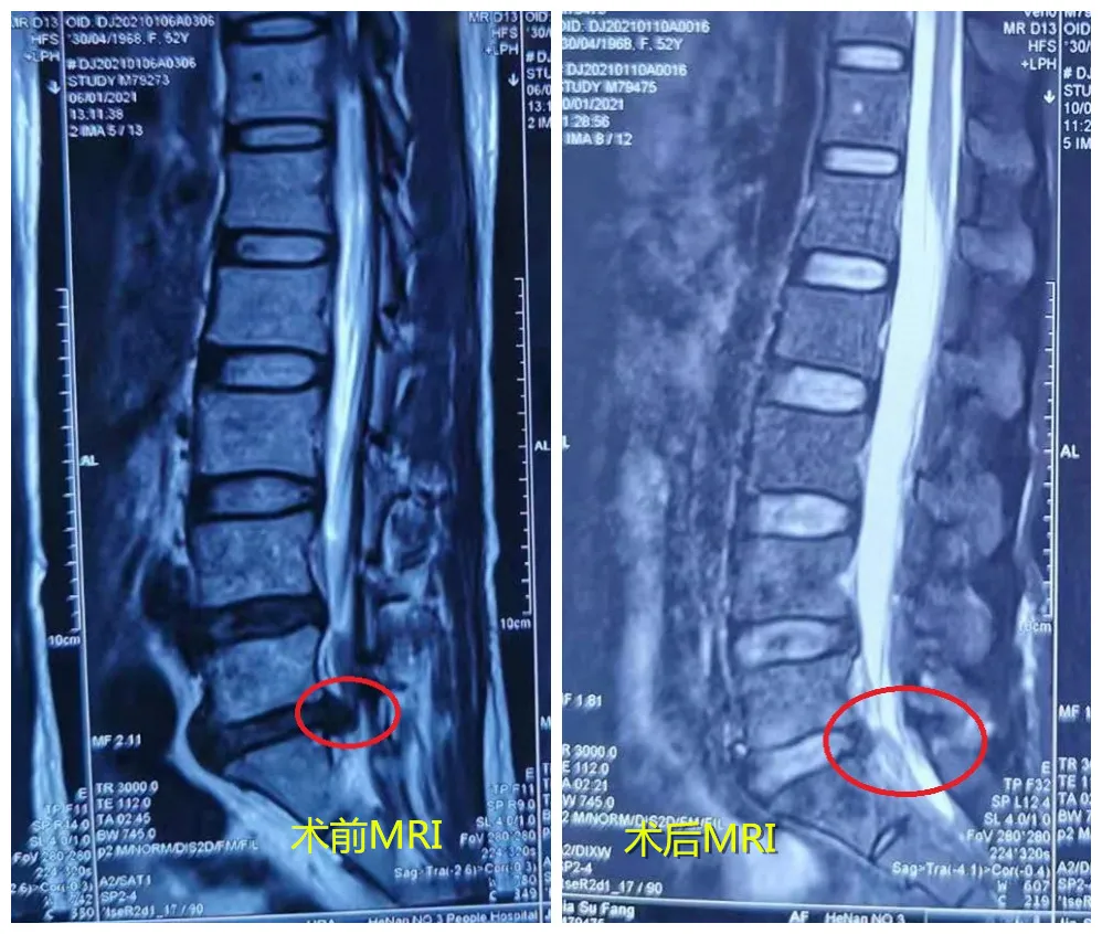 1615253936723018.jpg 1615253936723018.jpg