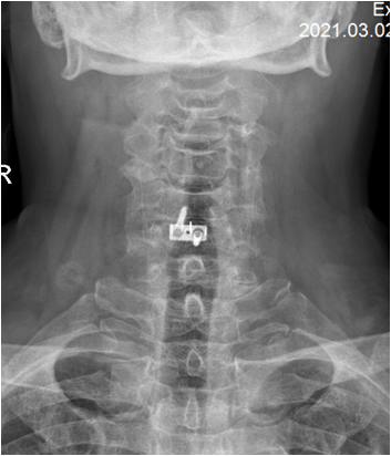 1623148175952487.png 术后 图片1.png