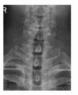 1623148224599981.jpg 术前 图片1.jpg