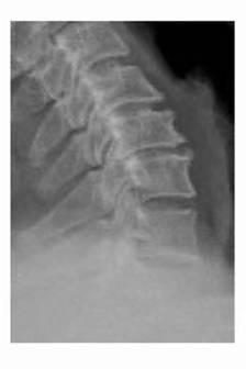 1623148255646290.jpg 术前 图片3.jpg