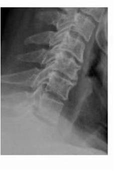 1623148271980560.jpg 术前 图片4.jpg