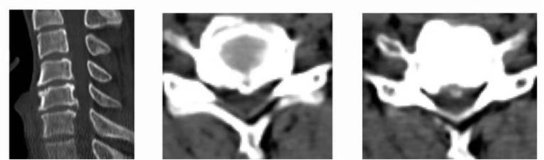 1623148344330896.jpg 术前 图片5.jpg