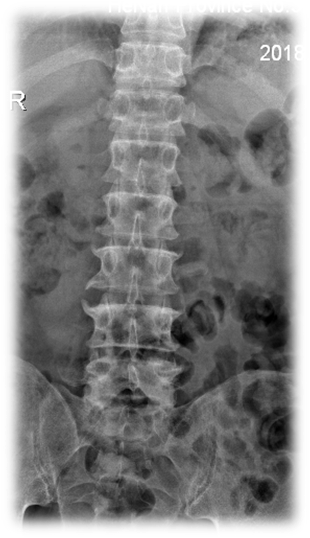 1623148875516263.png 术前 图片1.png