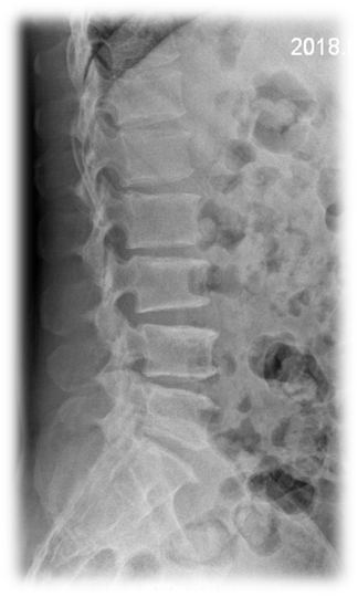 1623148901187964.png 术前 图片2.png