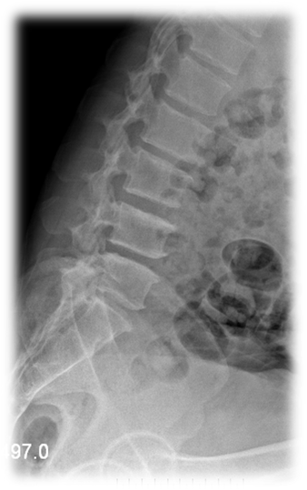 1623148914599353.png 术前 图片3.png