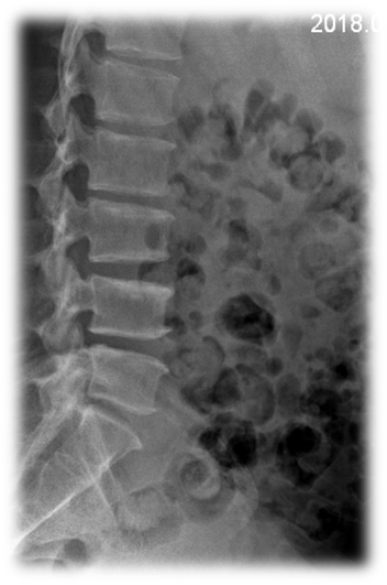 1623148924714910.png 术前 图片4.png