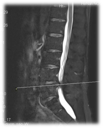 1623148940867336.jpg 术前 图片5.jpg