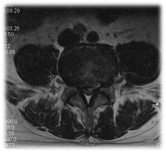 1623148952641723.jpg 术前 图片6.jpg