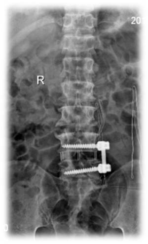 1623148966347882.jpg 术后 图片1.jpg