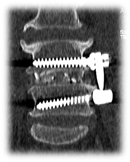 1623149004788186.png 术后 图片4.png