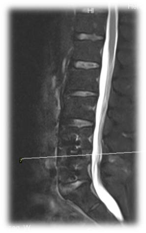 1623149013364109.jpg 术后 图片5.jpg