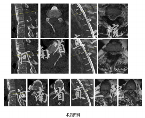 1742870127985704.png 图片.png